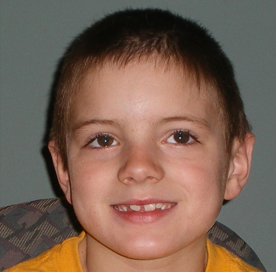 Sam peterson before_brazones